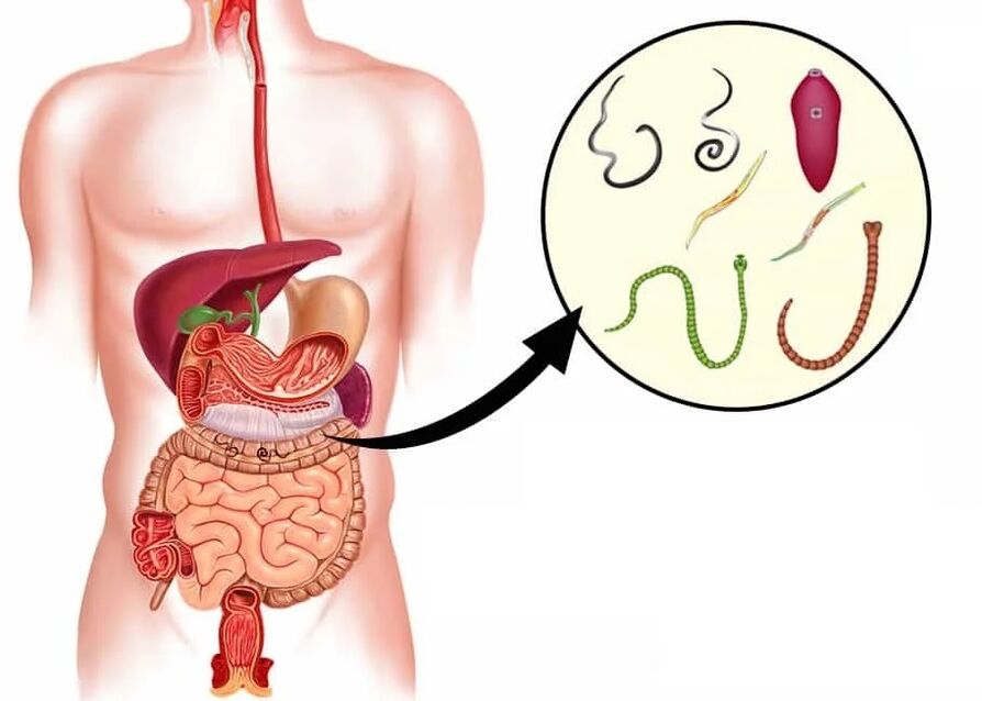 Vermixin padeda nuo daugelio helmintų tipų