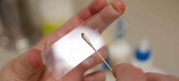 Sliekų kiaušinėlių gramdymas